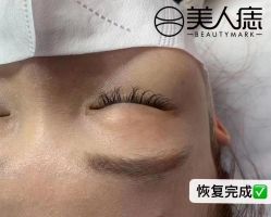 -美人痣全国连锁