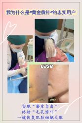 -北京米扬丽格医疗美容·联合丽格鼻整形中心