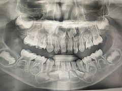 -宁波儿童口腔医院(钱湖院区)