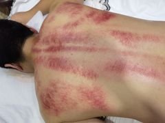 -麻麻手推拿