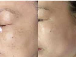 -Cream88颜皮肤管理中心