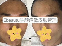-E.beauty驻颜·痘敏肌调理中心