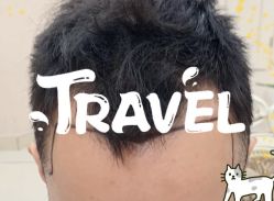 -大麦微针植发全国连锁