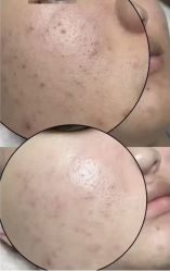 -禾壹净·素颜美问题肌肤修护中心