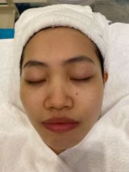 -agge蛋白医美