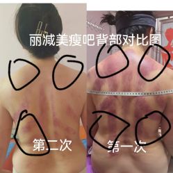 -丽减美瘦吧·减肥瘦身