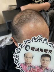 -唐风采假发补发定制