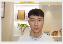 -大麦微针植发全国连锁