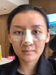 -北京米扬丽格医疗美容·联合丽格鼻整形中心