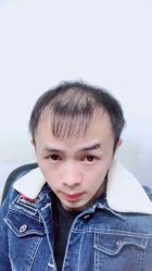 -发饰美男士增发补发假发定制店