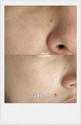-E.beauty驻颜·痘敏肌调理中心