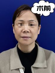 -素美医疗美容·西南眼鼻整形·修复基地