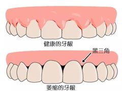 -团圆口腔·种植中心(锦江院区)