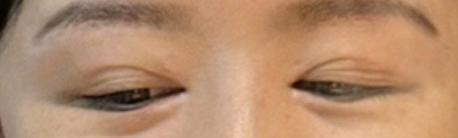 -西安现代妇产医院医疗美容