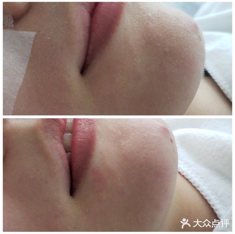 我基本一周到两周去做一次