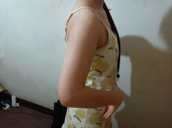 -成都西区医院整形美容