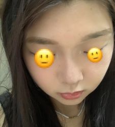-素美医疗美容·西南眼鼻整形·修复基地