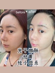 -AiCure 埃可儿·韩国医学皮肤管理