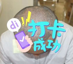 -大麦微针植发全国连锁