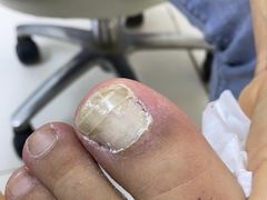 -新甲连锁灰指甲·甲沟炎·鸡眼(黑龙江路店)