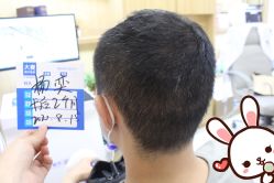 -大麦微针植发丨全国连锁