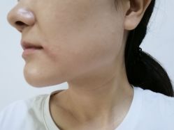点击看大图 -郑州优恩医疗美容医院