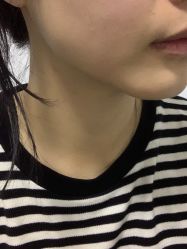 体验后-智美品质医美