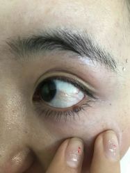 -痣清宫祛斑祛痣连锁店