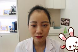 点击看大图 -大麦微针植发丨全国连锁