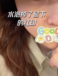 -小忠丽格医美