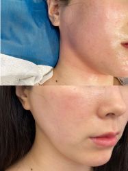 -圣嘉新医疗美容医院