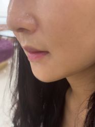 -广州美莱医疗美容医院