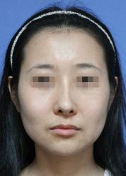 -圣嘉新医疗美容医院