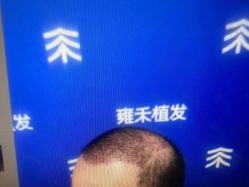 -雍禾植发全国连锁