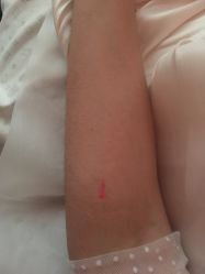 -肥三针腧穴瘦身馆