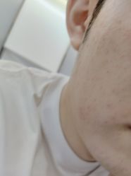 -美瑞莎创美医疗美容