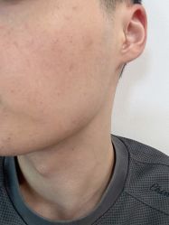 体验前-南宁华美医疗美容医院