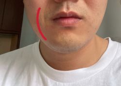 -上海漾颜医疗美容