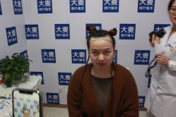 -大麦微针植发丨全国连锁