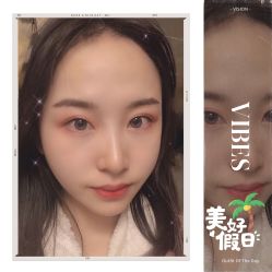 -大麦微针植发全国连锁