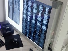 -张钰强中医正骨推拿连锁(华发商都店)