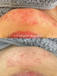 点击看大图 -MLP美丽派·问题肌疗愈中心