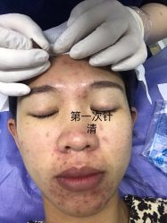 -广州美莱医疗美容医院