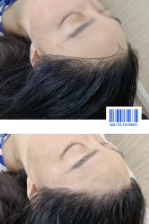点击看大图 -西施无菌半永久纹绣眉眼影唇轻增发纹发际线