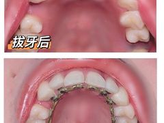 -极光口腔·矫正种植修复(锦江店)