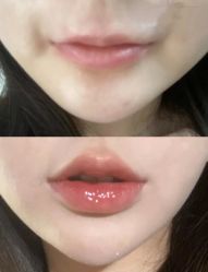 -东莞西妃整形美容医院