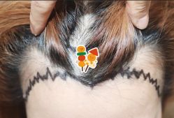 -大麦微针植发全国连锁