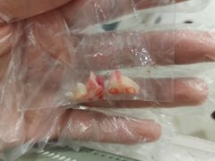 -爱齿尔口腔美学种植中心(永清院)