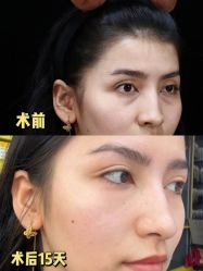 -上海伊莱美医疗美容医院