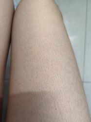 -MUSES专业脱毛比基尼サロン日式连锁